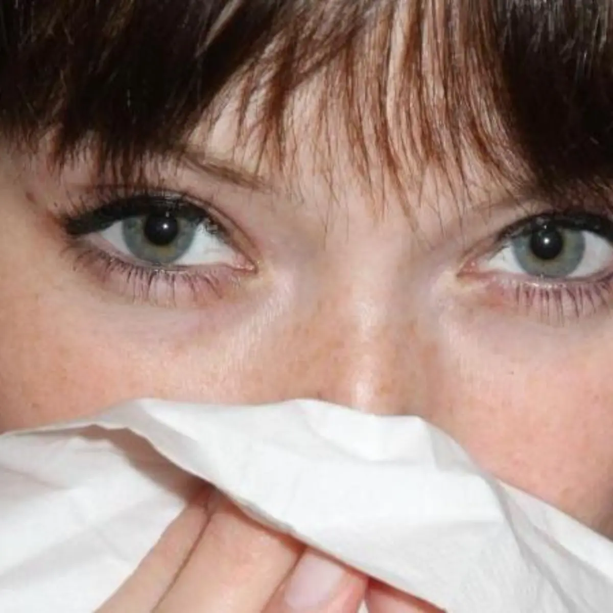 Nasenbluten (Epistaxis) Logo von Nasenbluten (Epistaxis)