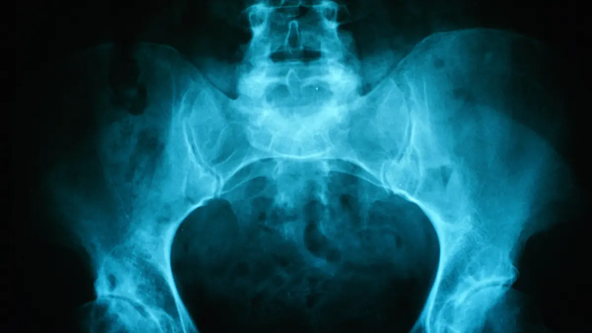 Medizin Radiologie
Röntgenaufnahme Becken mit Hüftgelenk und Lendenwirbelsäule von Frau medicine radiology x-ray of pelvis