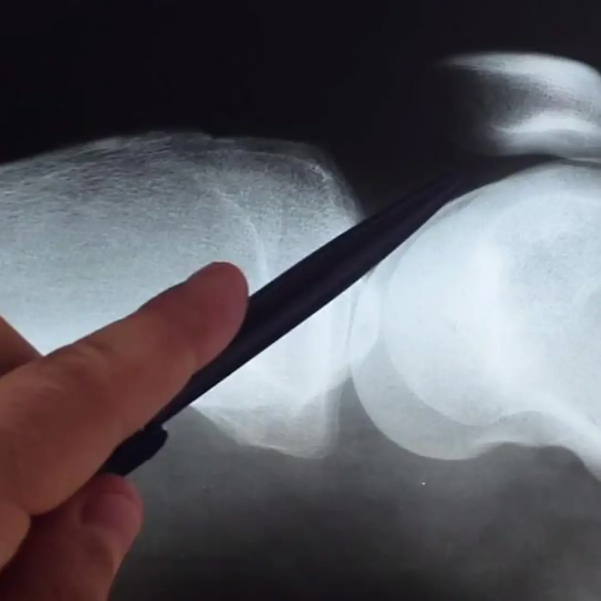 Kreuzbandriss Logo von Kreuzbandriss