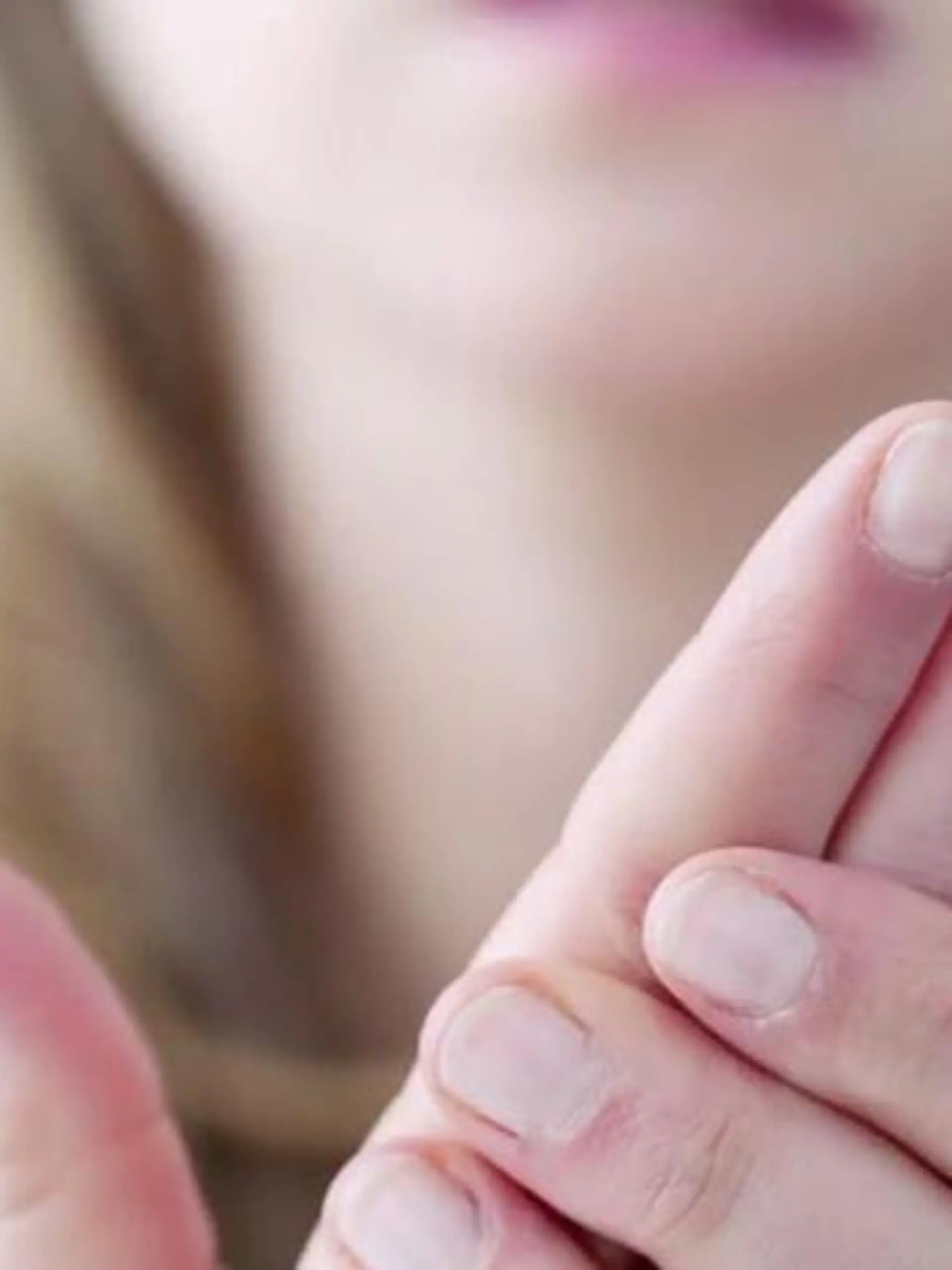 Bild zu: "Raynaud-Syndrom"
