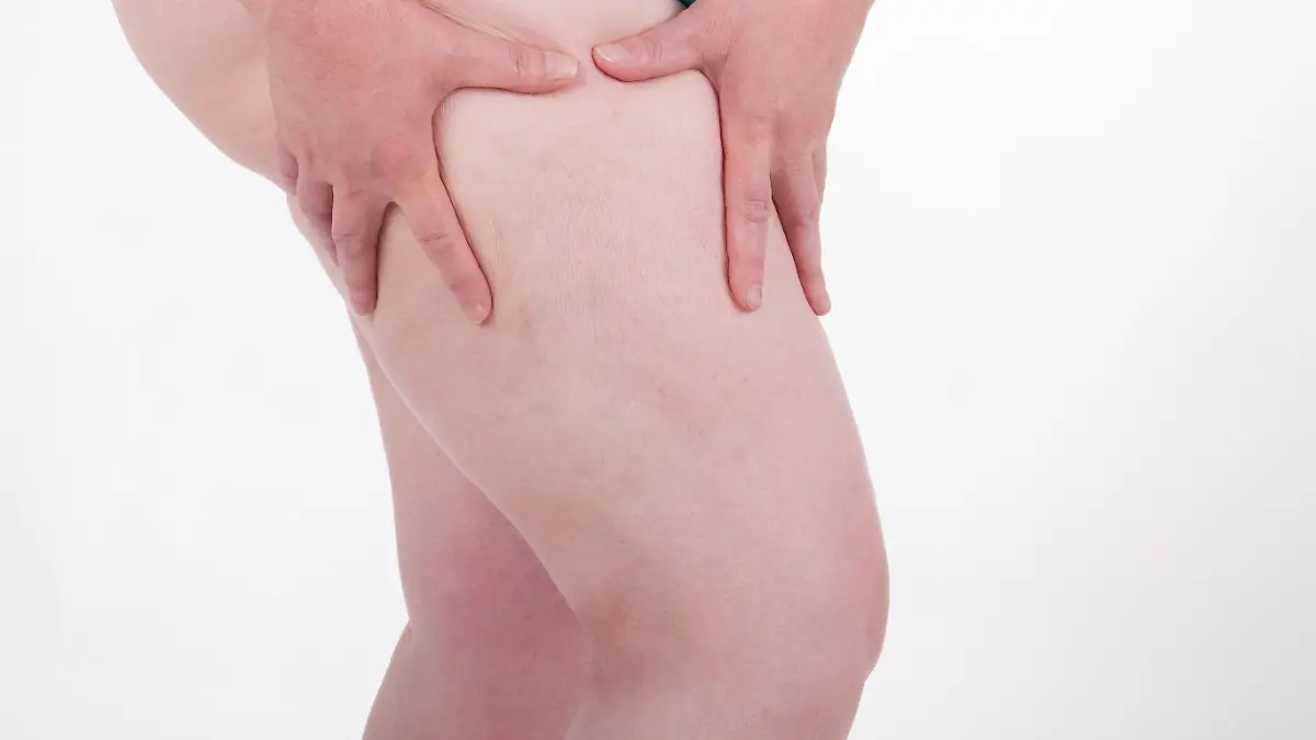 Eine dicke Frau betrachtet die Cellulite auf ihrem Oberschenkel.