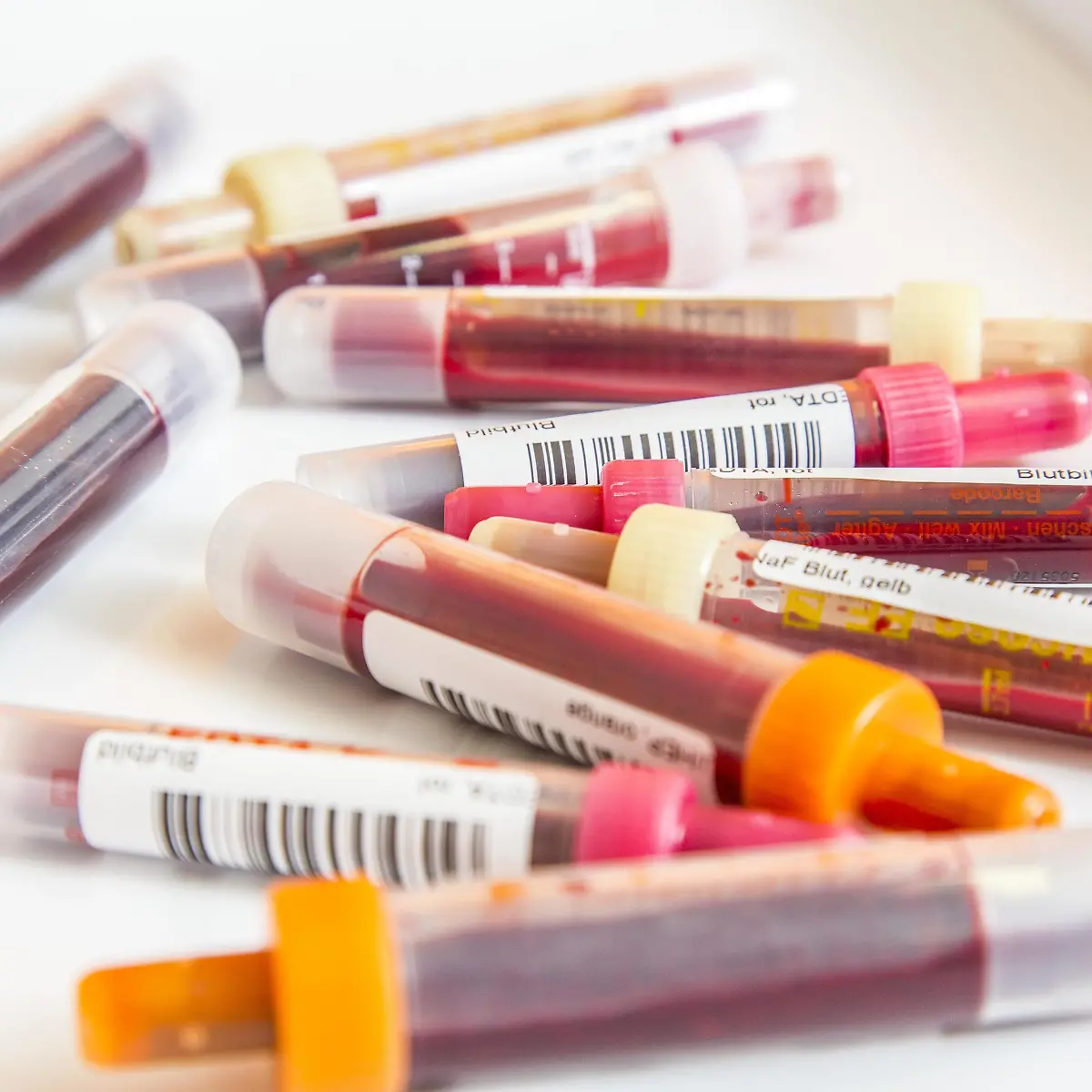 Plasmozytom (Multiples Myelom) Logo von Plasmozytom (Multiples Myelom)