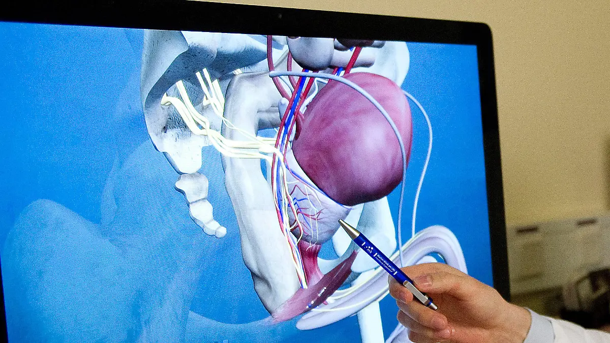ARCHIV - Eine Hand mit einem Stift zeigt am 11.02. 2013 in Hamburg in der Martini-Klinik am Universitätsklinikum Hamburg-Eppendorf (UKE) auf ein 3D-Modell einer Prostata. Foto: Axel Heimken/dpa (Zu dpa "Studie sieht Fehlentwicklung bei Prostatakrebs-Operationen") | Verwendung weltweit