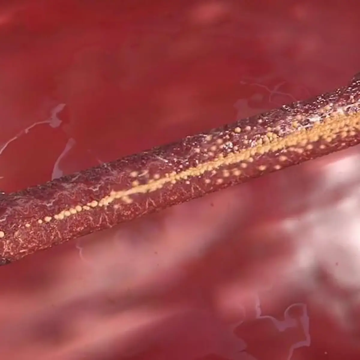 Fisteln Logo von Fisteln