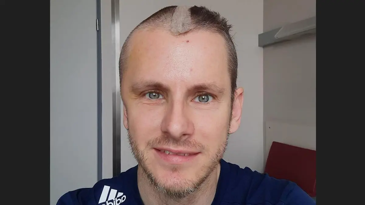 Jörg Hartmann nach dem Unfall.