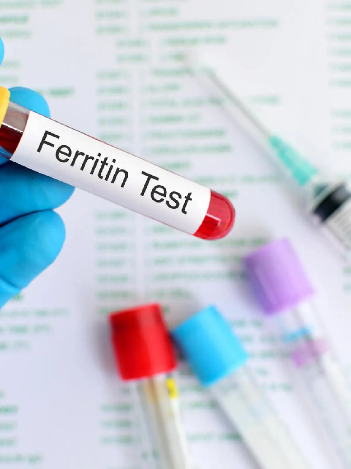 Blood sample for ferritin test, anemia disease diagnosis