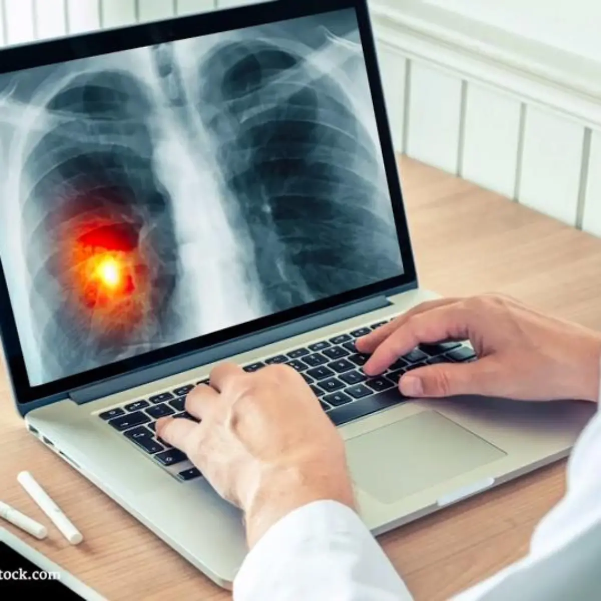 Karzinom Logo von Karzinom