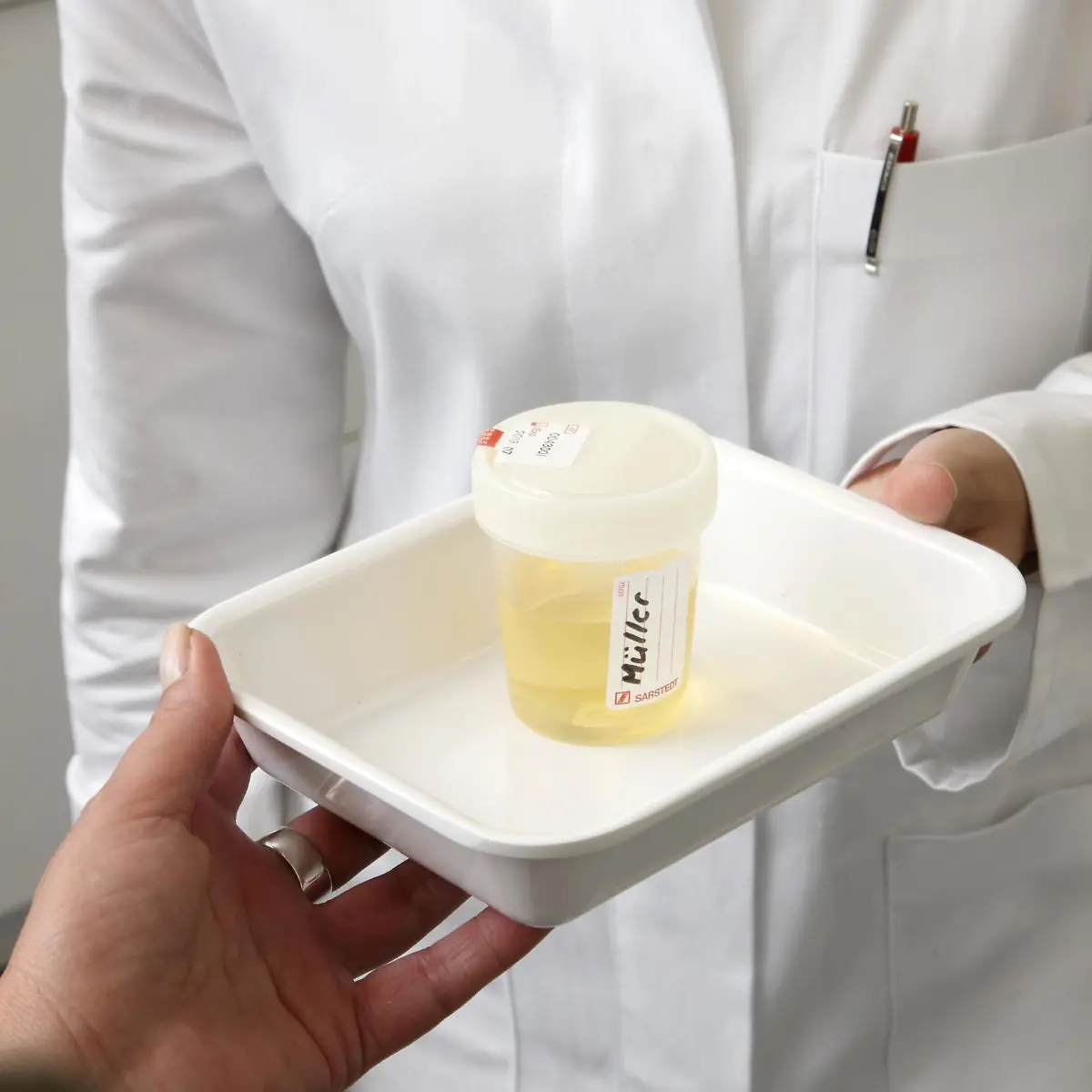 Nierenentzündung (Glomerulonephritis) Logo von Nierenentzündung (Glomerulonephritis)