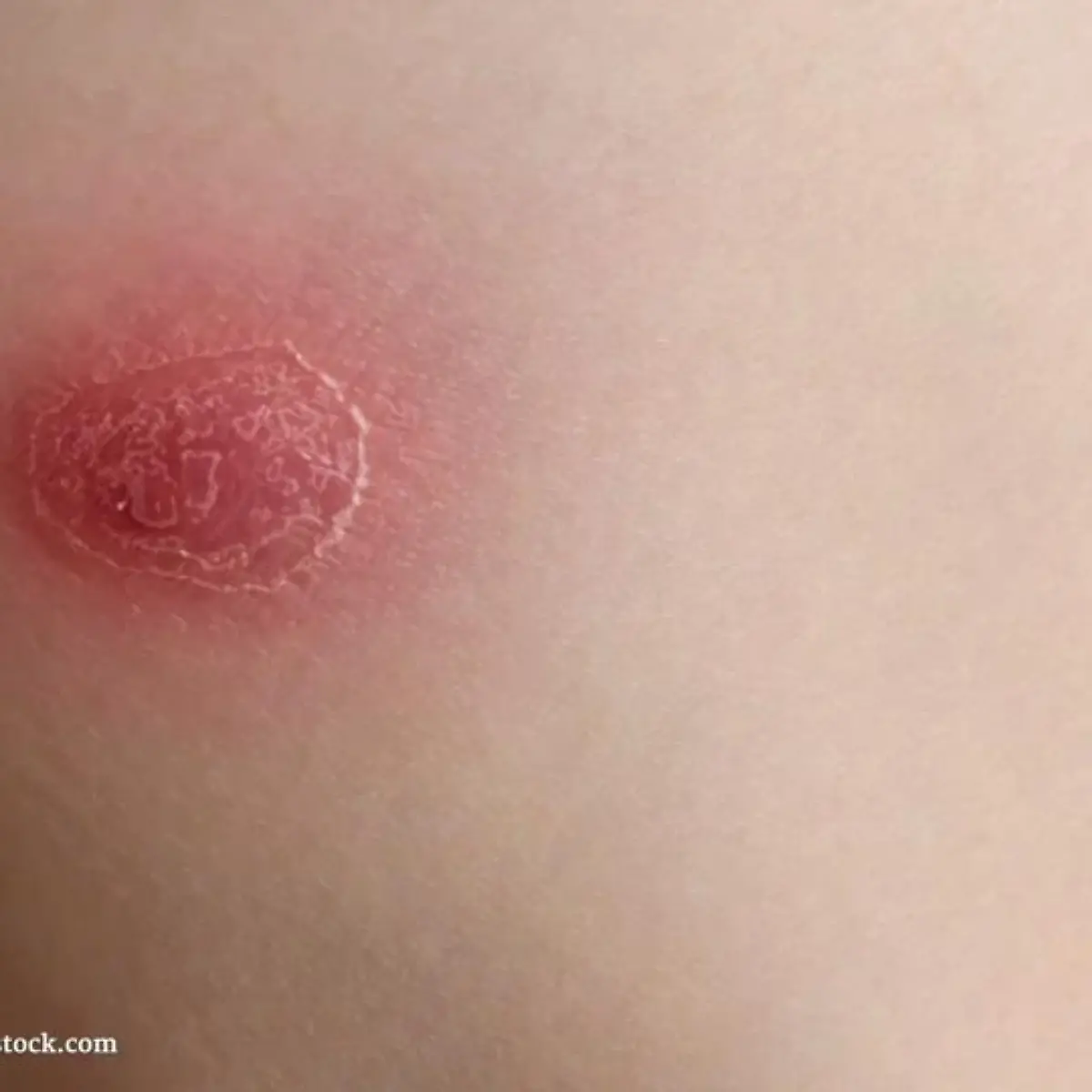 Phlegmone Logo von Phlegmone