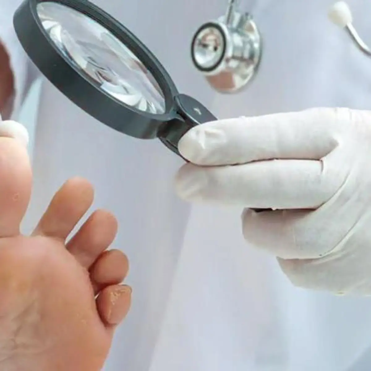 Nystatin Logo von Nystatin