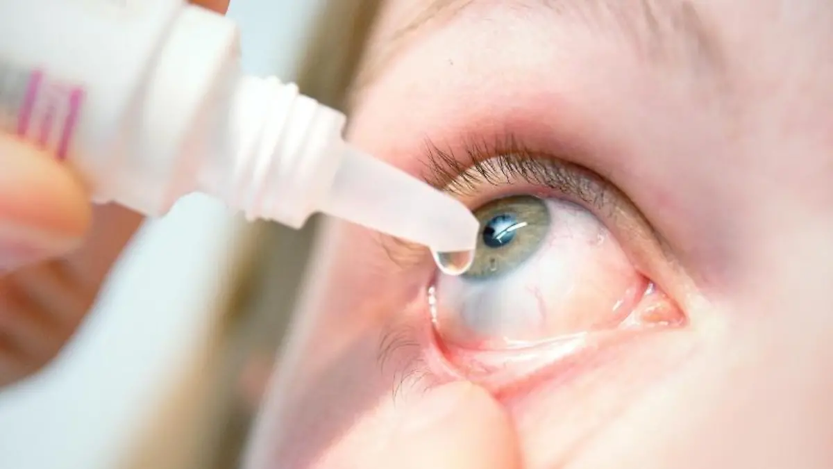 Augentropfen gegen Bindehautentzündung