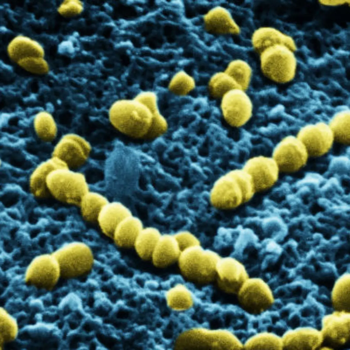 Pneumokokken Logo von Pneumokokken