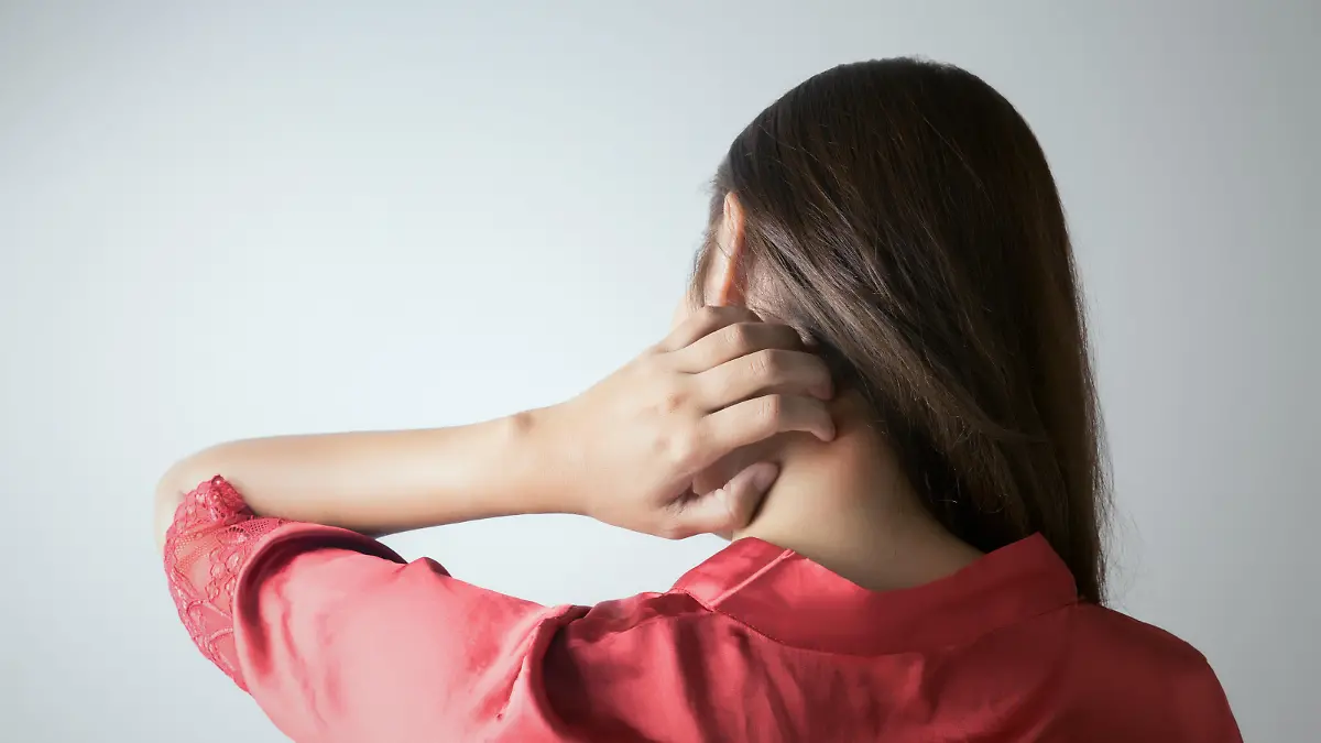 Junge Frau mit einem Exzem