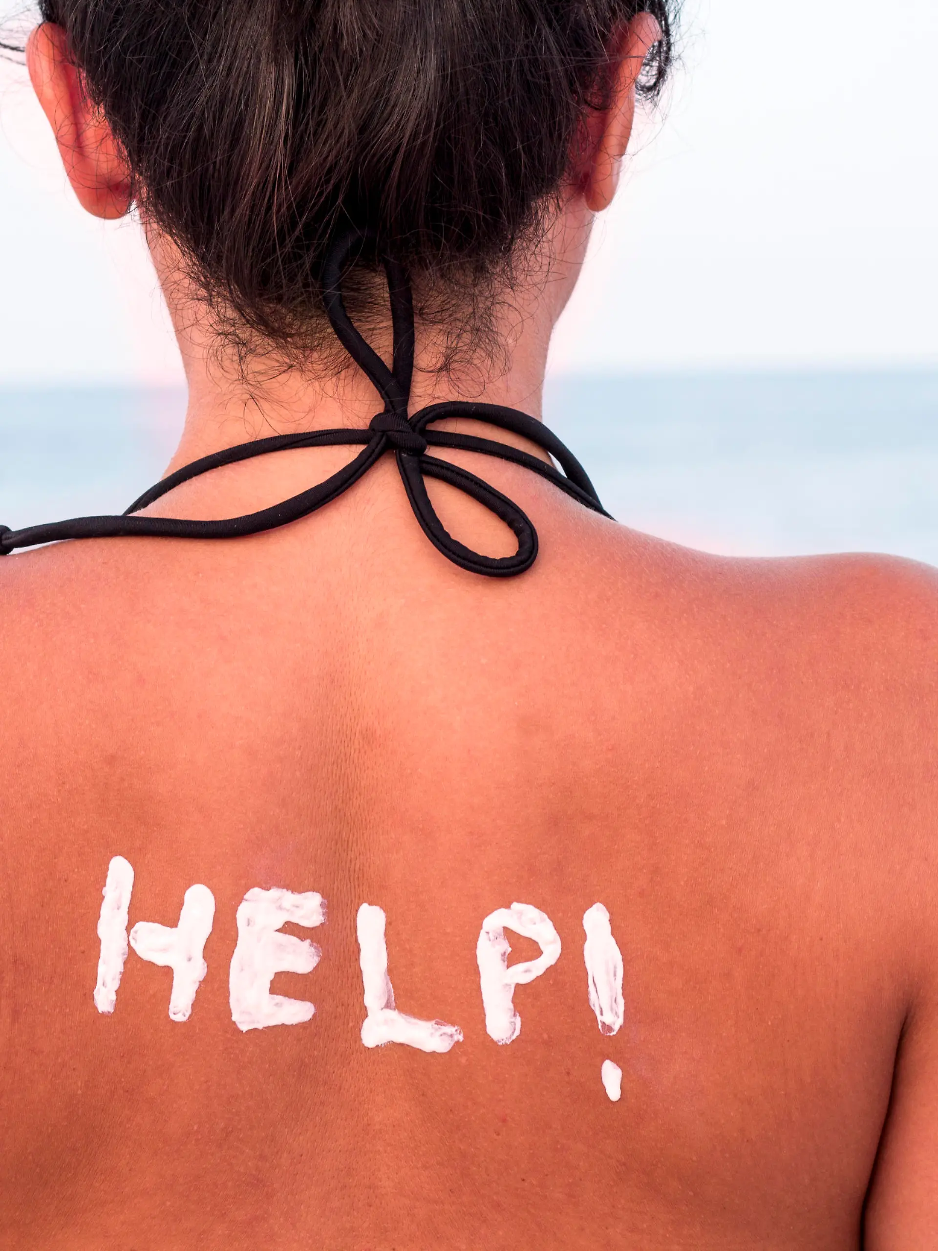 Bei viel Sonne die Haut ausreichend schützen - sonst droht ein Sonnenbrand
