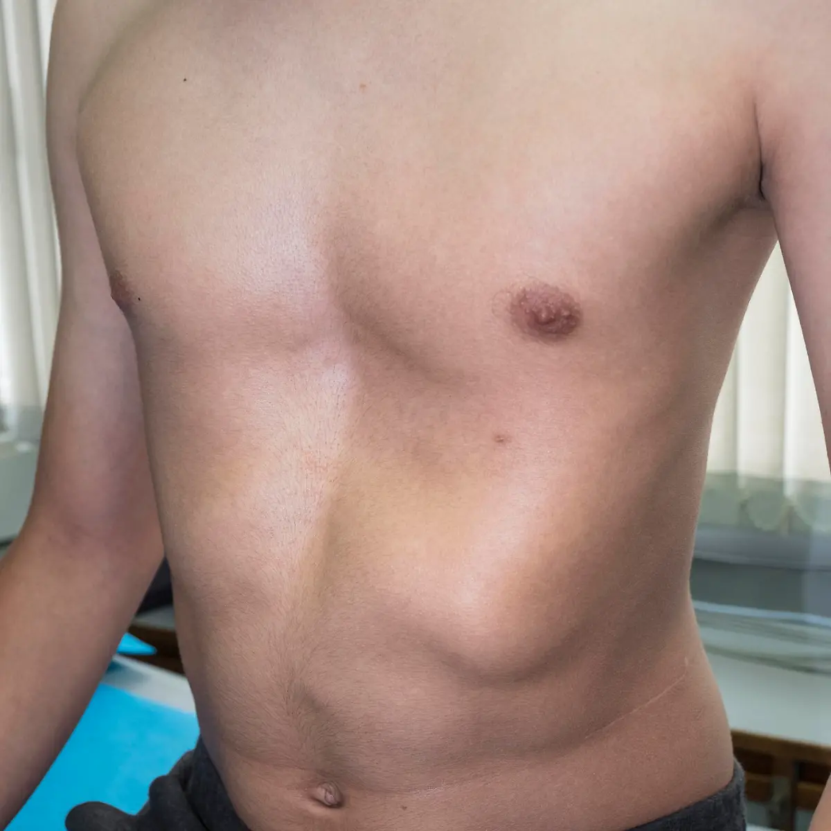 Trichterbrust Logo von Trichterbrust