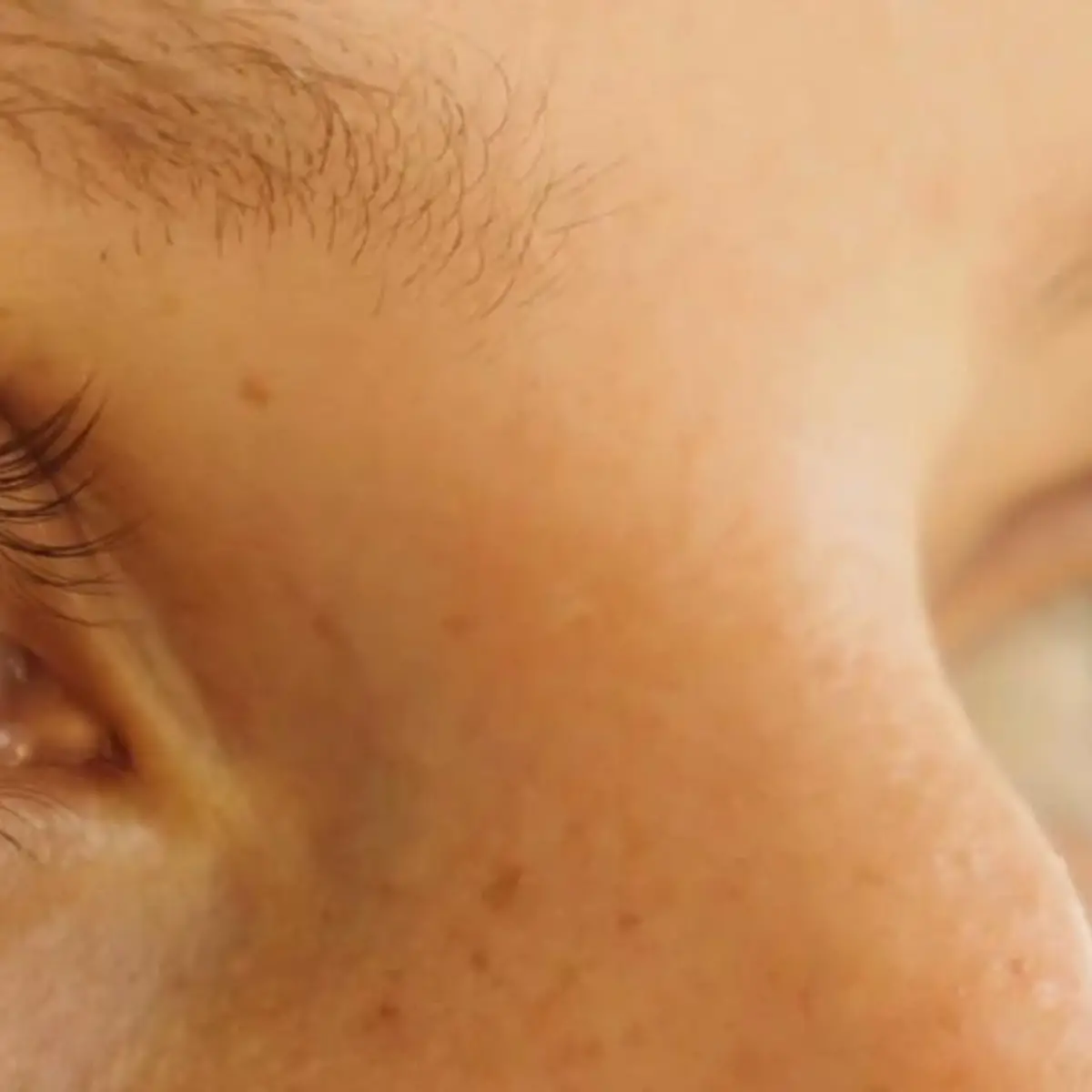 Kurzsichtigkeit (Myopie) Logo von Kurzsichtigkeit (Myopie)