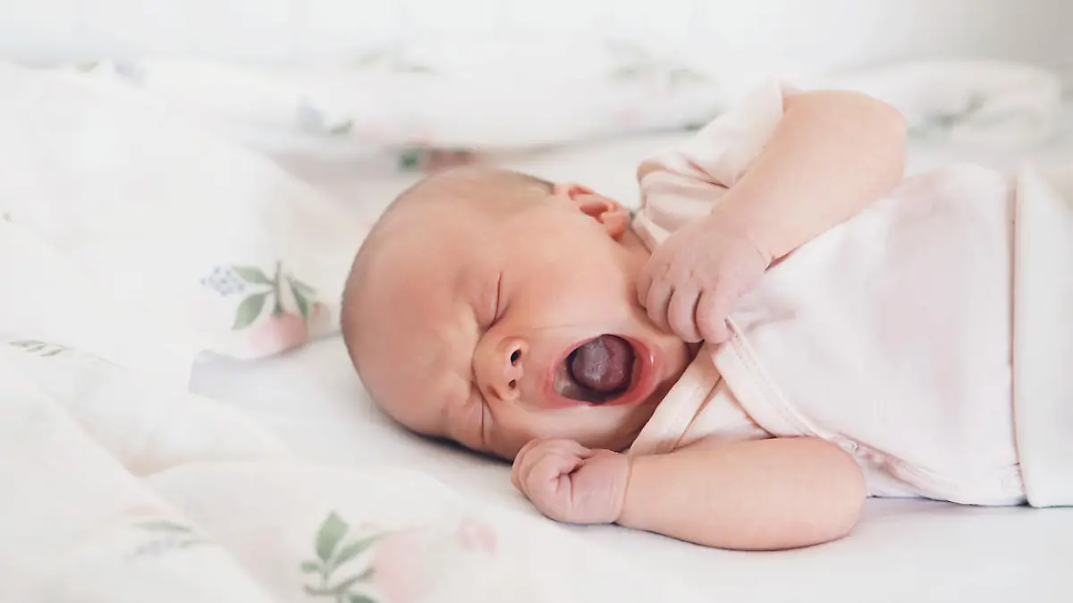 Neugeborenes Baby gähnt und hat eine weißliche Zunge, ein Zeichen für Mundsoor.