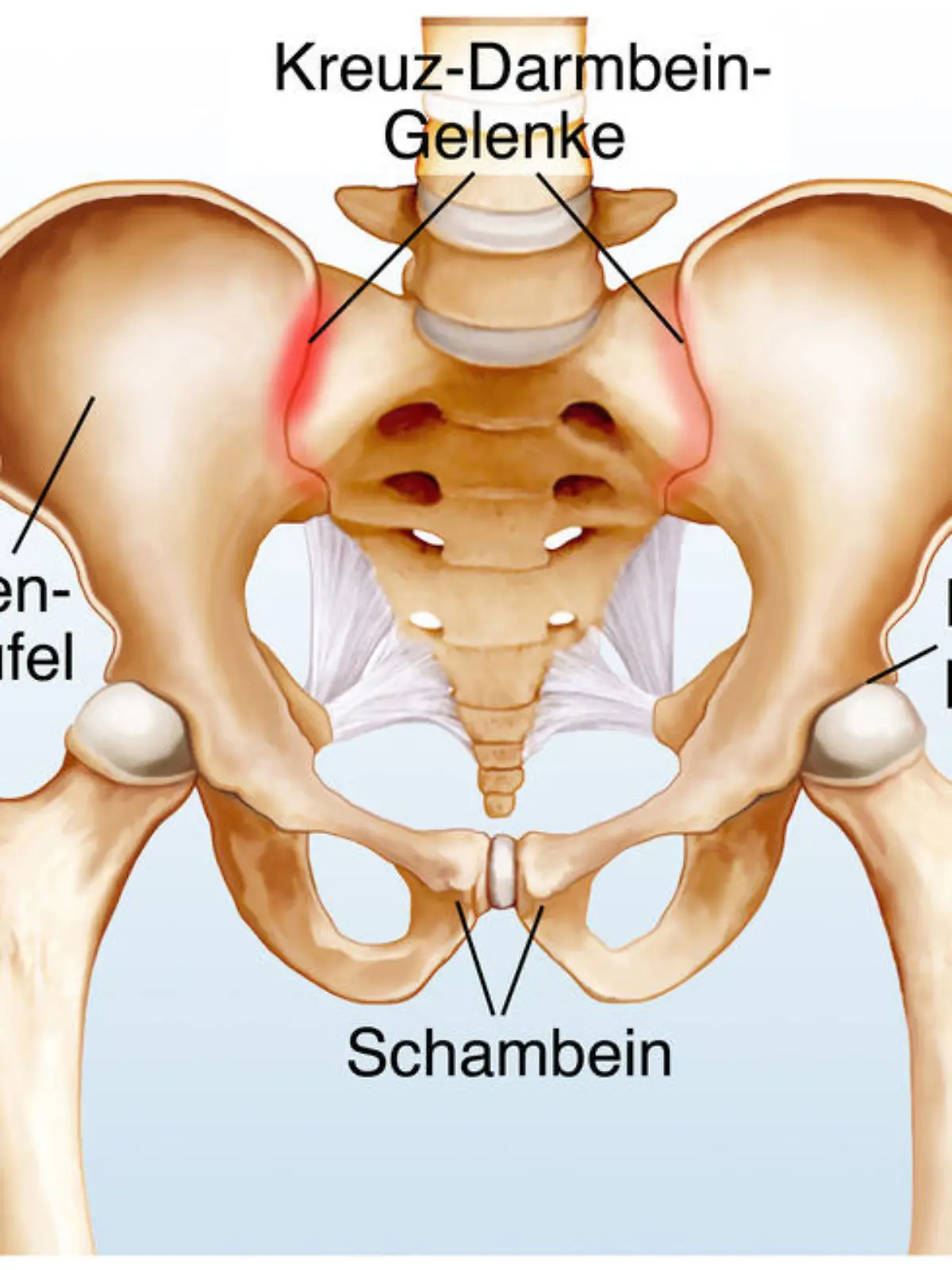 Schmerzen am Rand der Beckenschaufel.Kreuz-Darmbein-Gelenke
