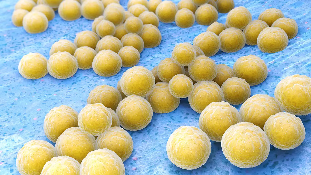 Staphylococcus aureus