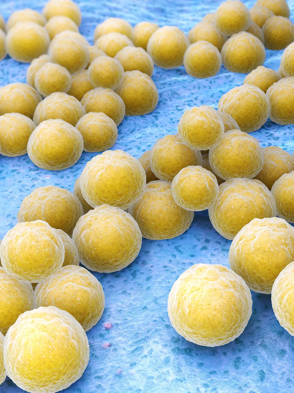 Staphylococcus aureus