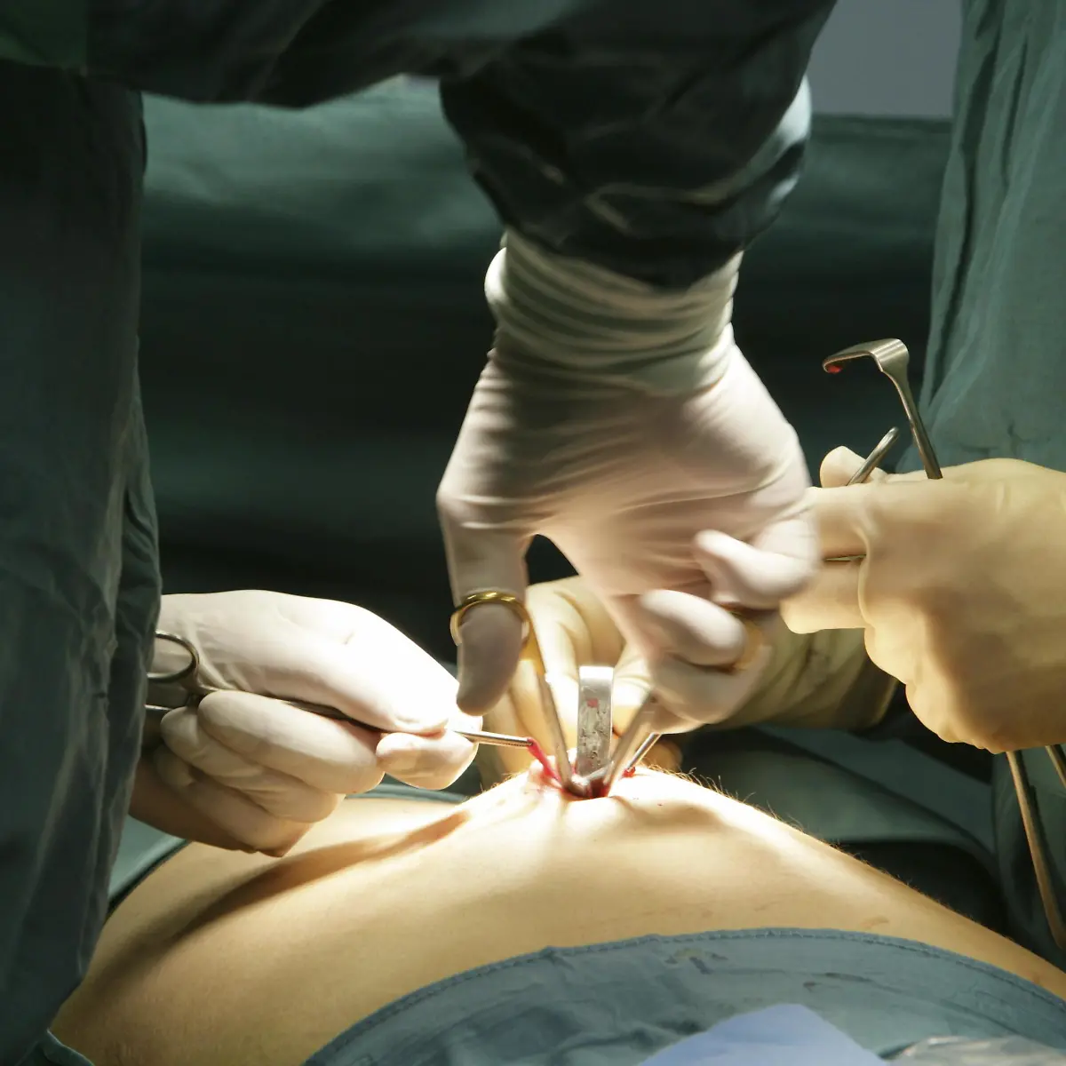 Laparoskopie (Bauchspiegelung) Logo von Laparoskopie (Bauchspiegelung)