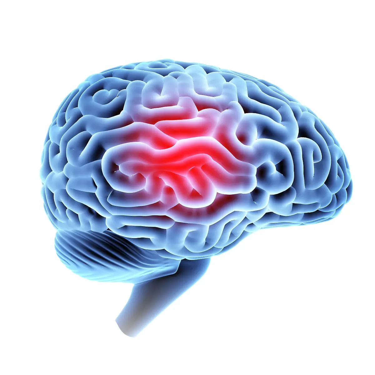 Subdurale Blutung Logo von Subdurale Blutung