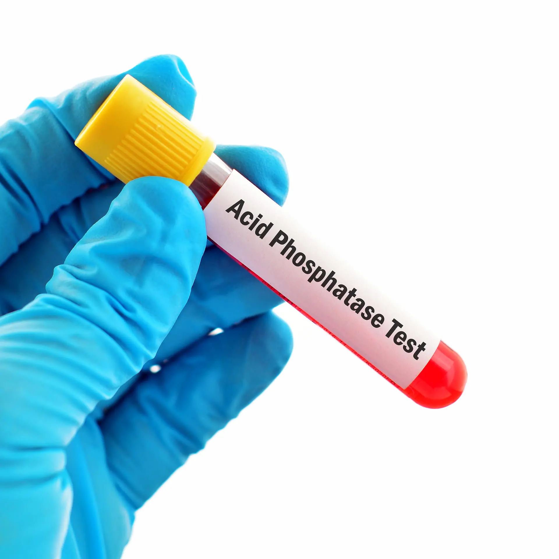 saure Phosphatase Logo von saure Phosphatase