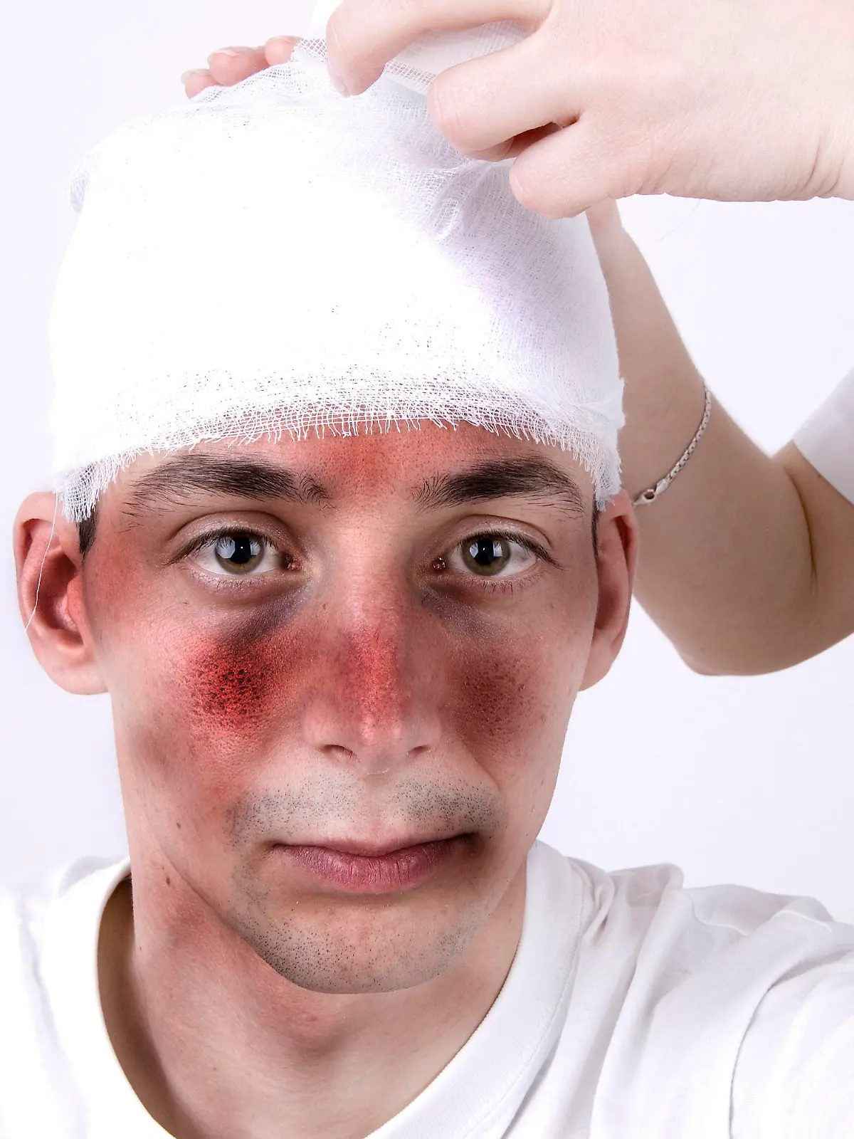 Mann mit Kopfverletzung (Schädel-Hirn-Trauma)