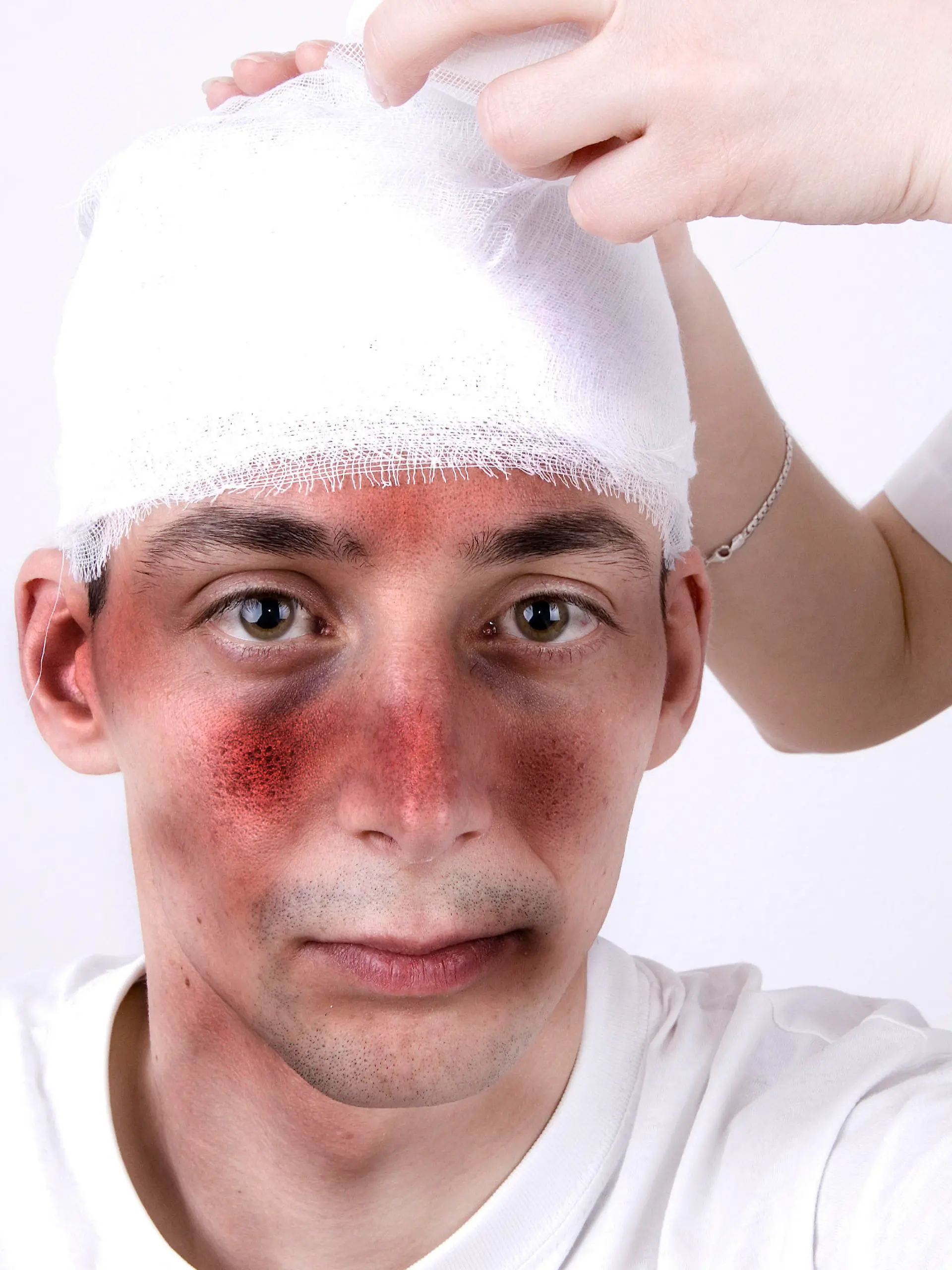 Mann mit Kopfverletzung (Schädel-Hirn-Trauma)