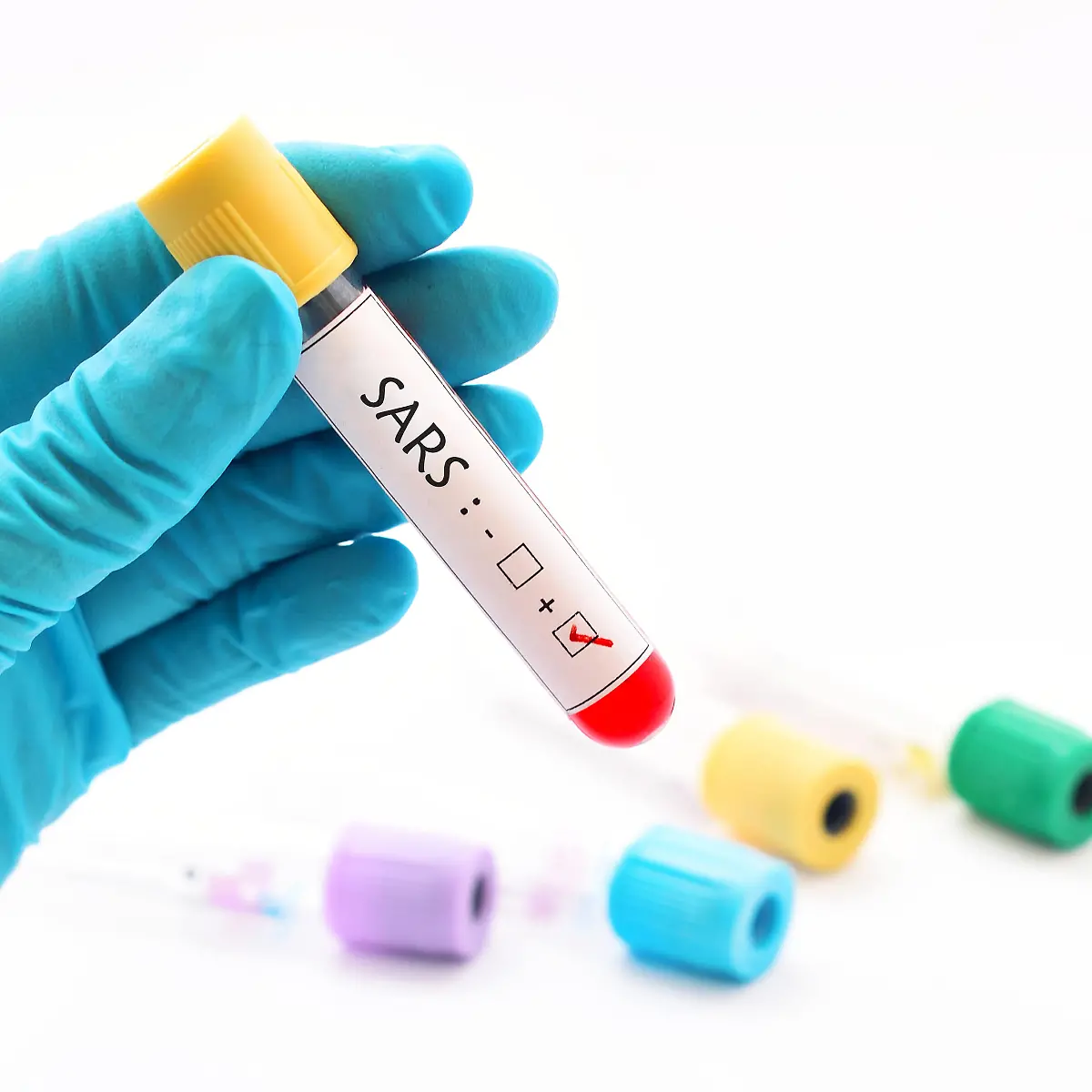 SARS (Schweres Atemwegs-Syndrom) Logo von SARS (Schweres Atemwegs-Syndrom)