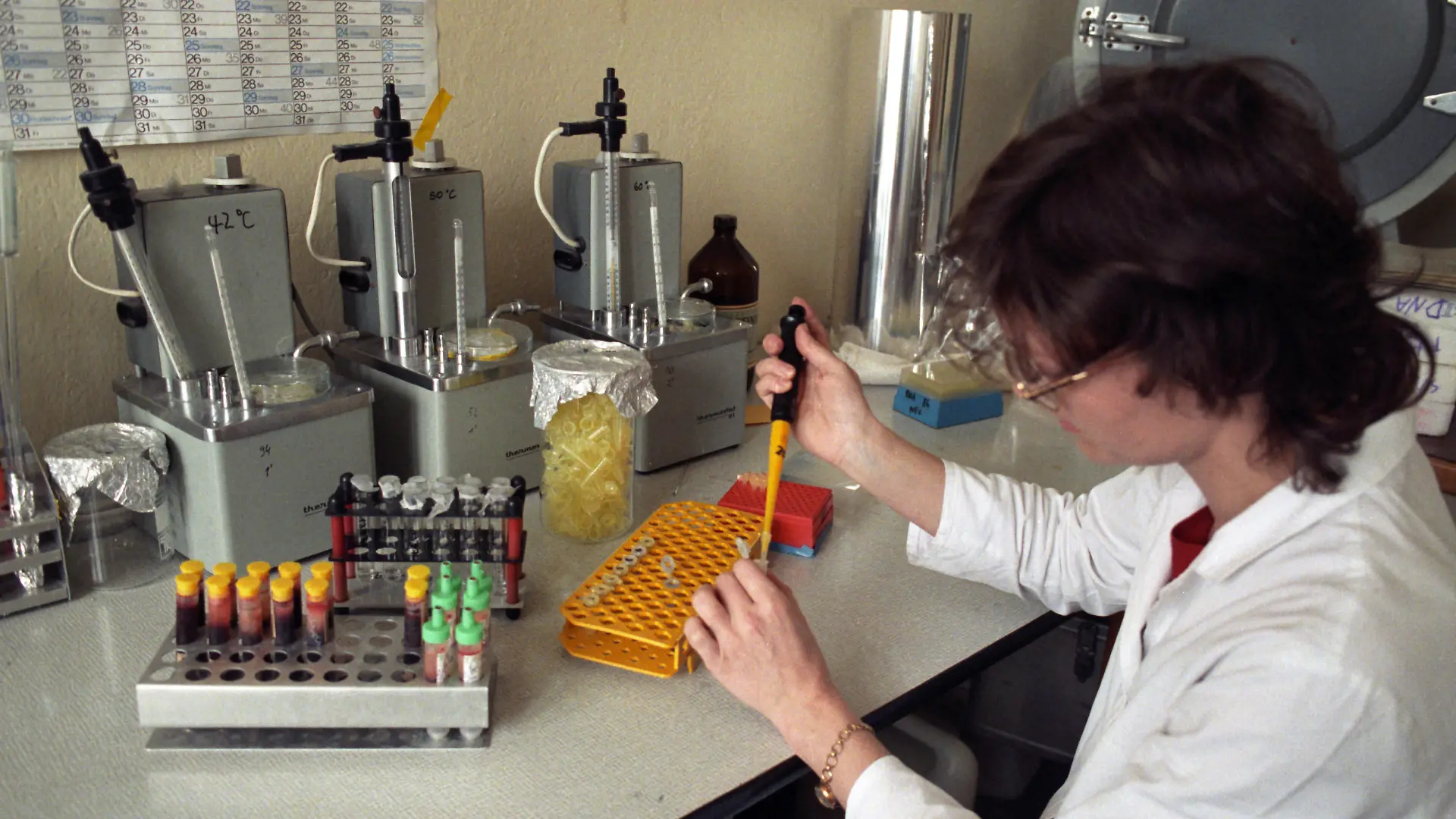 Untersuchungen der DNA-Flüssigkeit von Elternund ungeborenen Kindern, bei denen der Verdacht auf eine mögliche Erbkrankheit vorliegt, werden am Institut für medizinische Genetik der Universität Greifswald vorgenommen. Das Institut ist einzige Einrichtung auf dem Gebiet der Ex-DDR für derartige Untersuchungen and analysiert das Blut aller Neugeborenen auf Phenylketonurie. Foto: Bernd Wüstneck +++(c) dpa - Report+++ | Verwendung weltweit