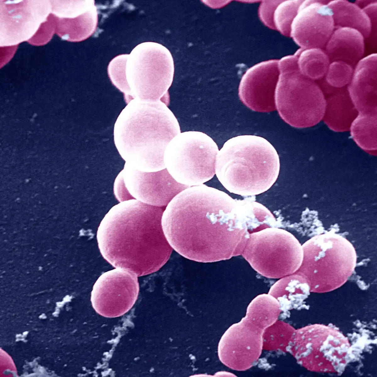 Pityriasis versicolor (Kleienflechte) Logo von Pityriasis versicolor (Kleienflechte)