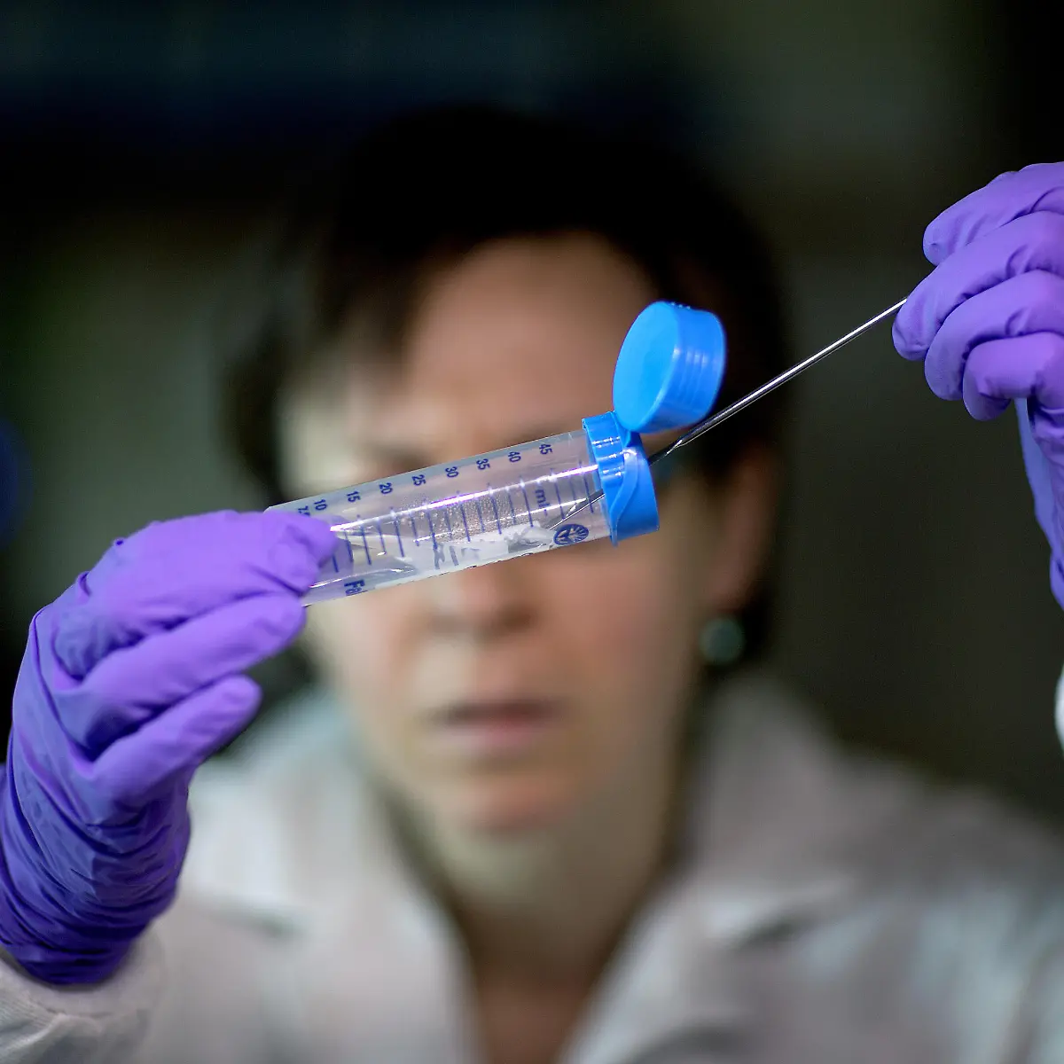 Listeriose (Listerien-Infektion) Logo von Listeriose (Listerien-Infektion)