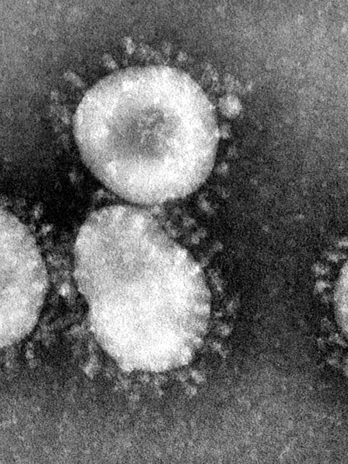 ARCHIV - HANDOUT - Das Handout des amerikanischen Centers for Disease Control (CDC) zeigt einen Coronavirus unter dem Mikroskop. (Aufnahme vom April 2003). Foto: Center for Disease Control/epa/dpa (zu dpa "Erster Mers-Fall in China bestätigt" vom 29.05.2015 - ACHTUNG: Nur zur redaktionellen Verwendung und nur bei vollständiger Nennung der Quelle: «Center for Disease Control») +++(c) dpa - Bildfunk+++