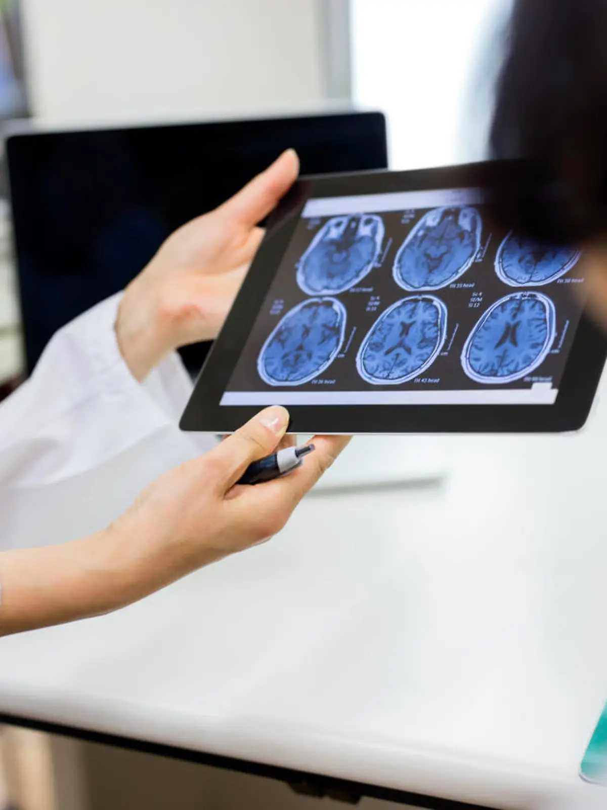 Scans eines menschlichen Gehirns zur Diagnose einer Hirnerkrankung