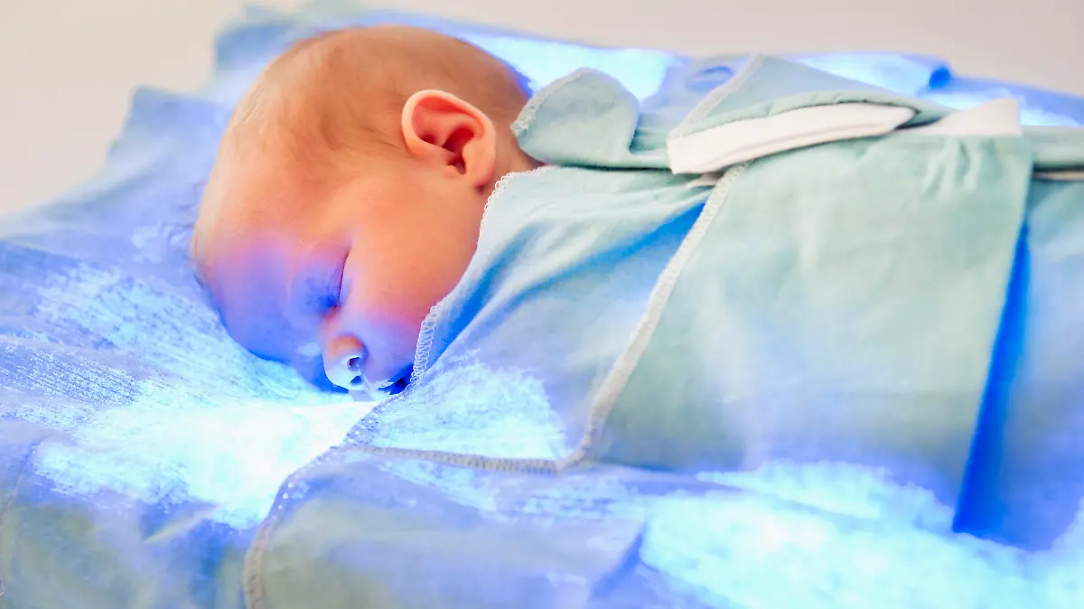 Fototherapy bei Neugeborenen-Gelbsucht (Kernikterus)