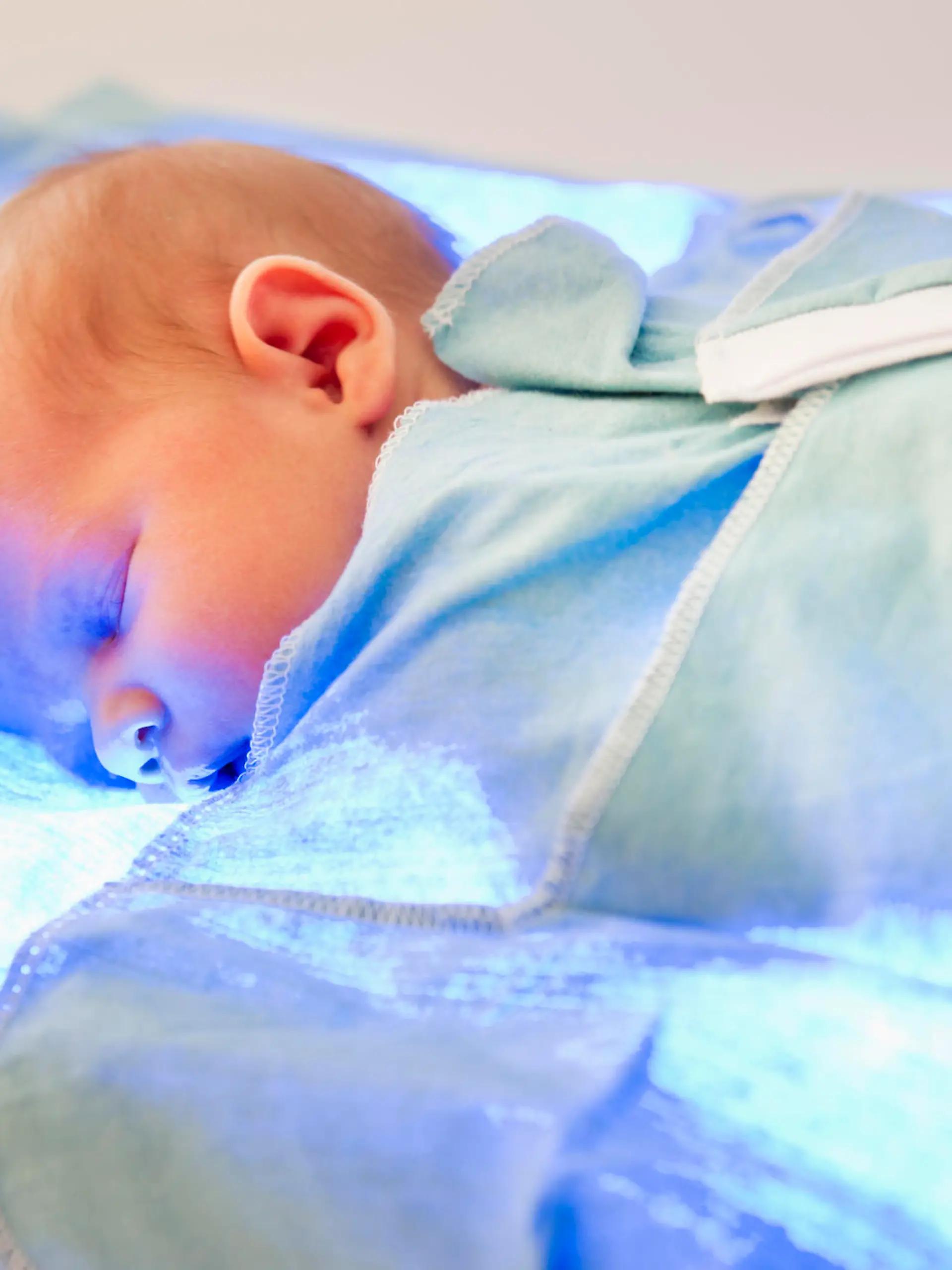 Fototherapy bei Neugeborenen-Gelbsucht (Kernikterus)