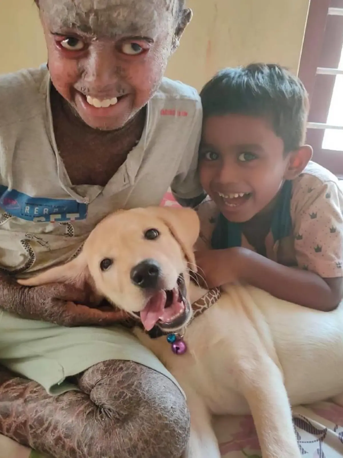 Namith aus Indien mit seltener Erkrankung