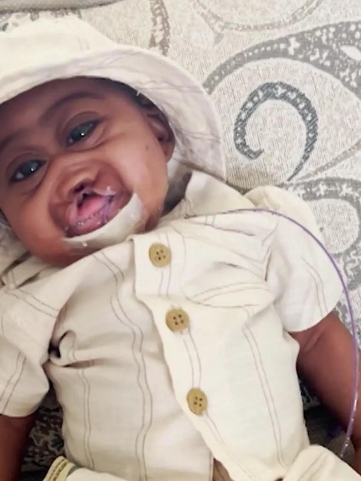Bild zu: "Ärzte gaben ihm nur 30 Minuten! Baby Kaden hat seltene Hirnstörung – doch er lebt!"