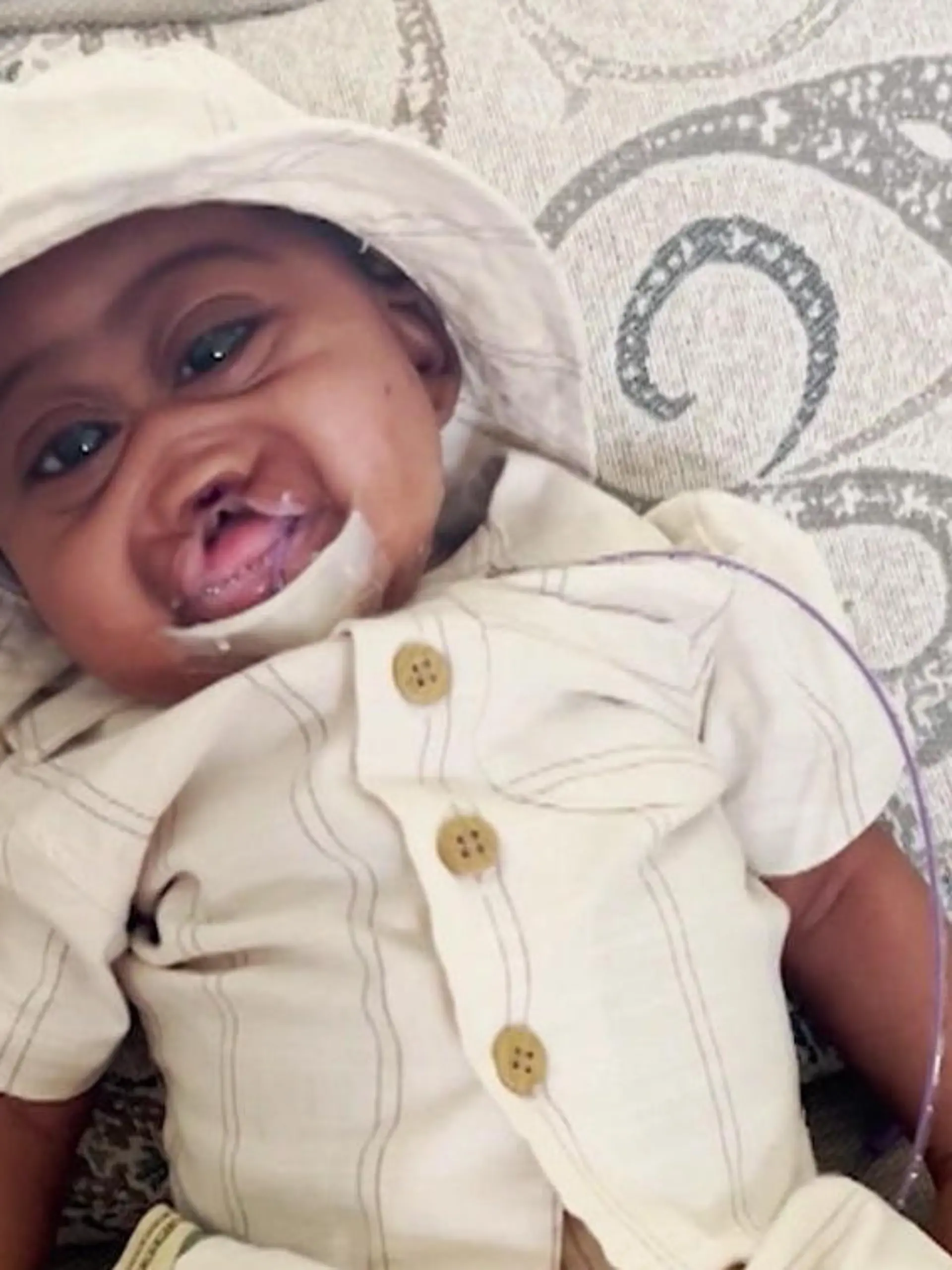 Bild zu: "Ärzte gaben ihm nur 30 Minuten! Baby Kaden hat seltene Hirnstörung – doch er lebt!"