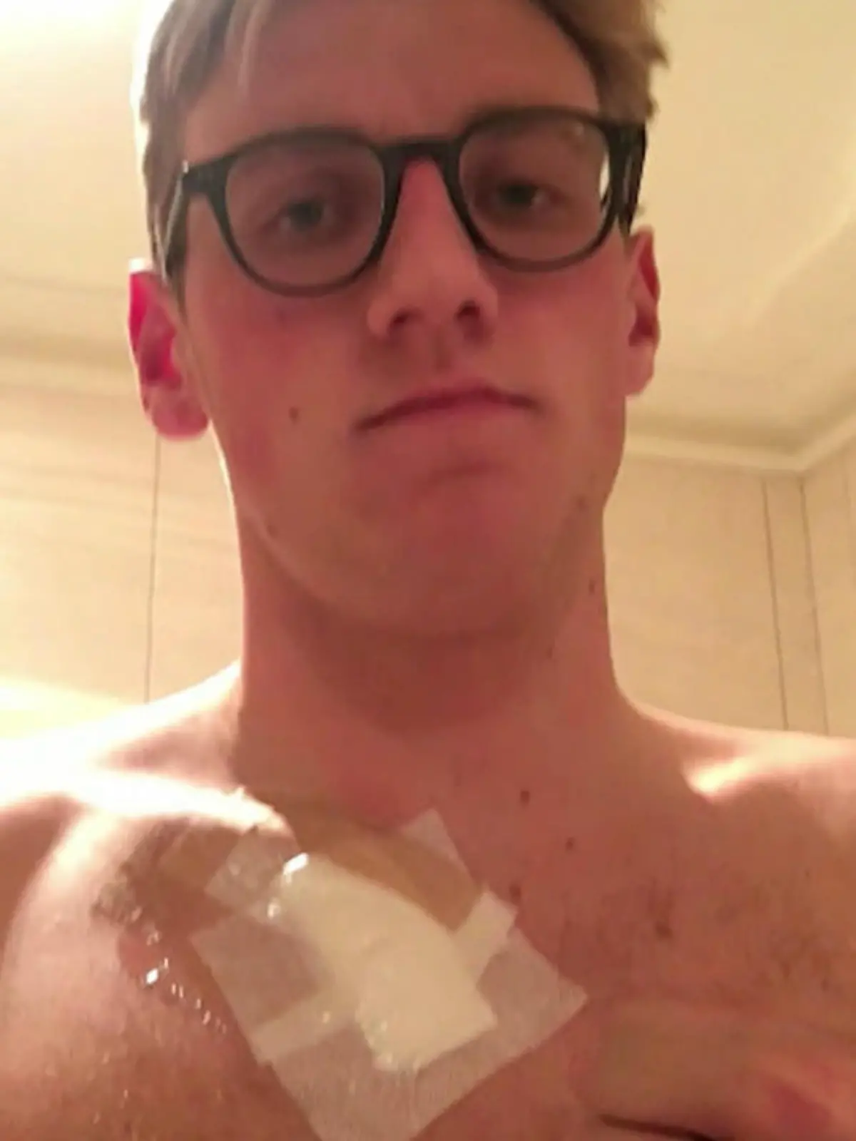 Mack Horton auf Instagram. Ein großes Pflaster bedeckt sein Schlüsselbein nachdem er sich ein Muttermal hat entfernen lassen.