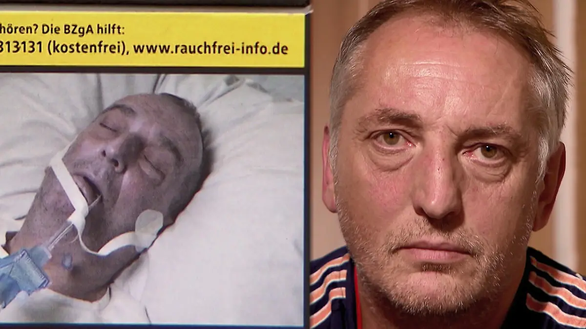 Sich selbst auf Zigaretten-Schockbild wieder erkannt Nichtmals wegen Rauchen operiert
