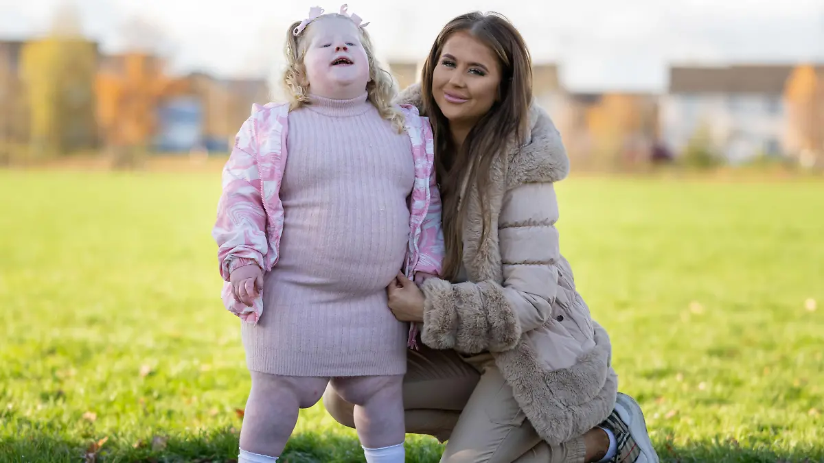 CATERS NEWS (PICTURED L-R Harlow alongside mum Holly) This mum has to have a baby gate on her kitchen so that her daughter, who Prader Willi Syndrome, can't help herself to food as she never feels full. Holly Williams, from Newport, Wales, says that her daughter, Harlow, five, is constantly hungry due to being diagnosed with Prader Willi Syndrome when she was six months old. The 25-year-old mum-of-one has to have a baby gate on her kitchen and keep food out of reach because as a result of her condition, Harlow is missing chromosome 15 which controls hunger, and therefore she is constantly hungry. While Harlow is currently overweight, Holly says that she has to remain stern and tell Harlow 'no', and ensures she eats a healthy, balanced diet. SEE CATERS COPY