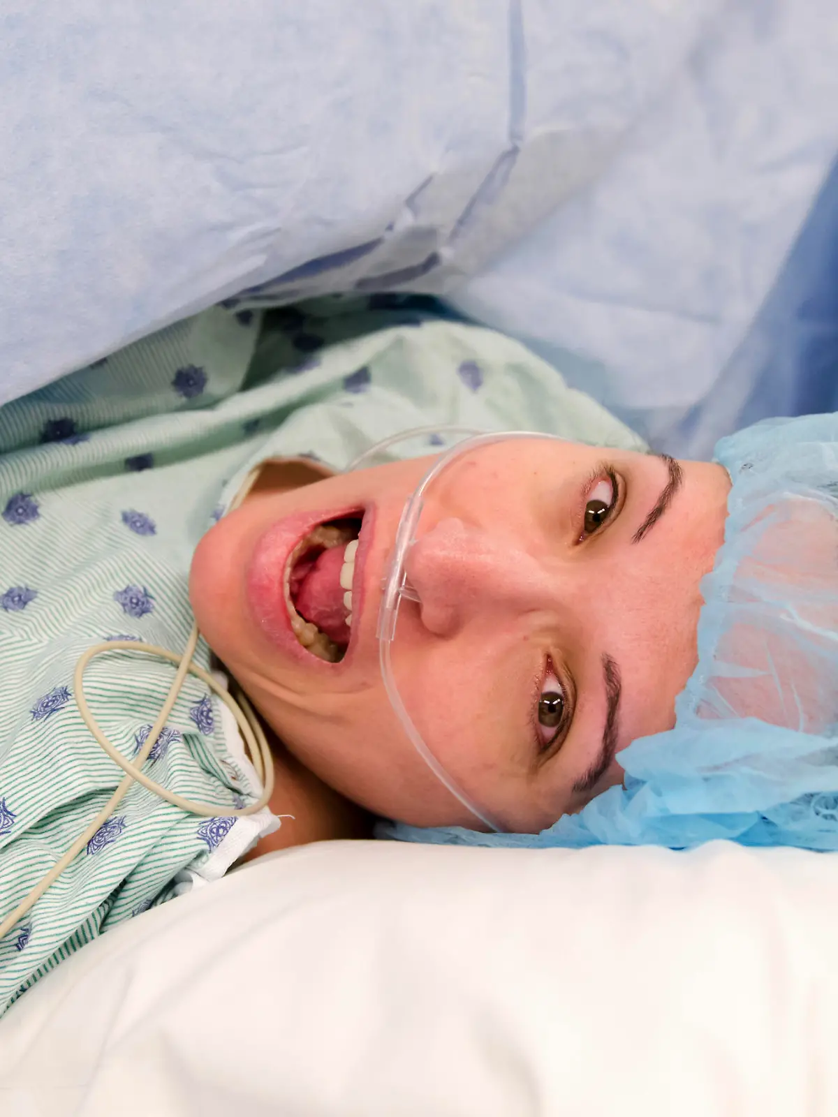 A woman is on an operating table during csection surgery with a horrified screaming expression.