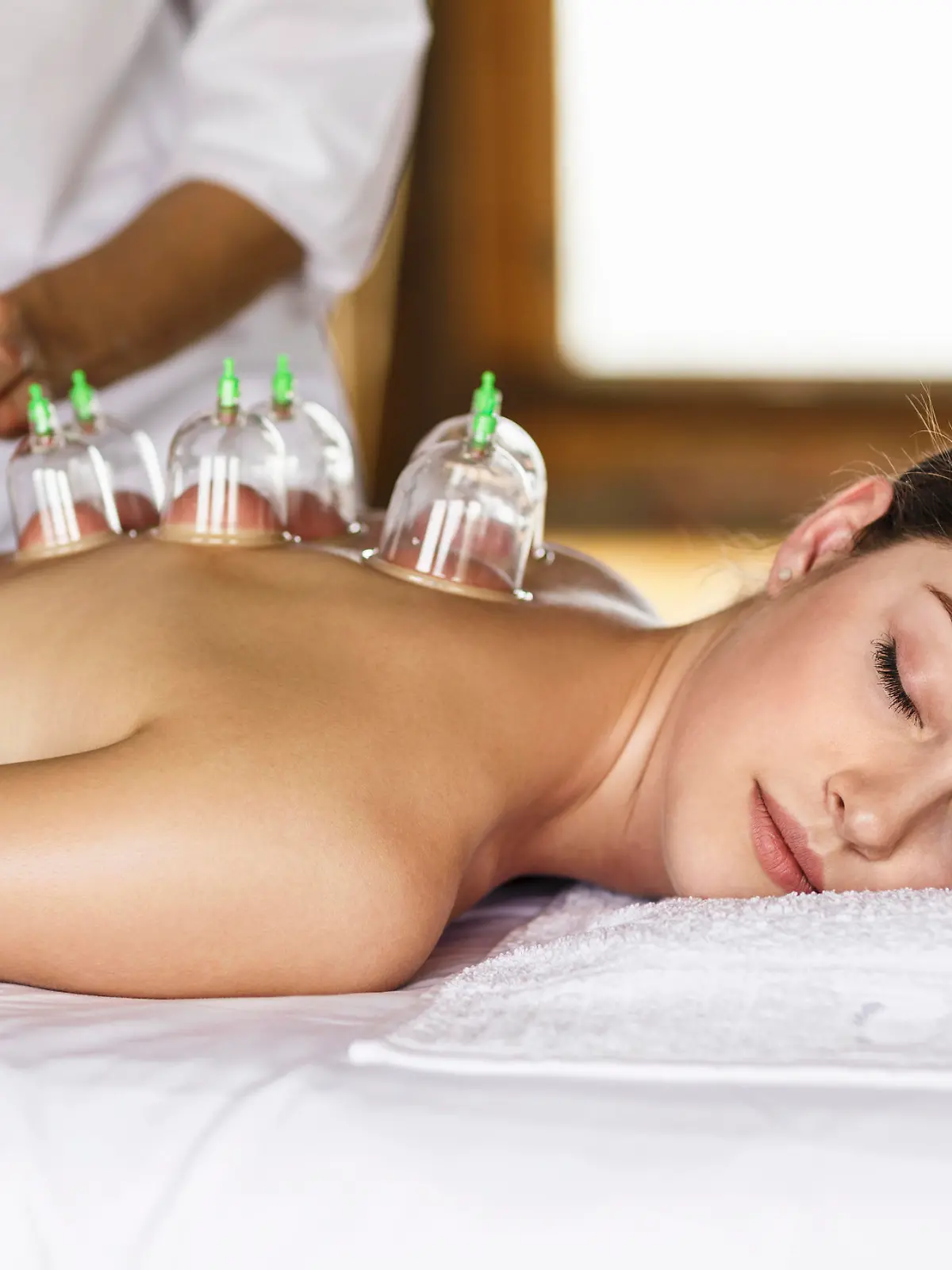 Woman laying on chest with cupping treatment on back