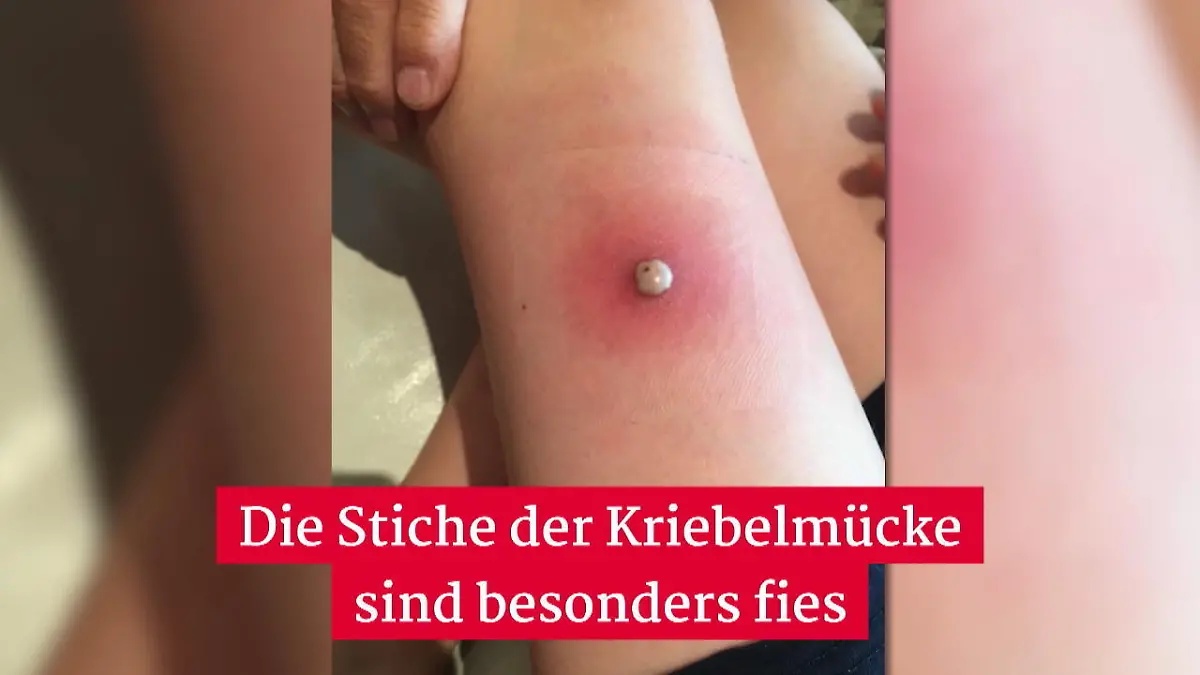 Lebensbedrohliche Gefahr durch Kriebelmücke Gefährliche Bisse