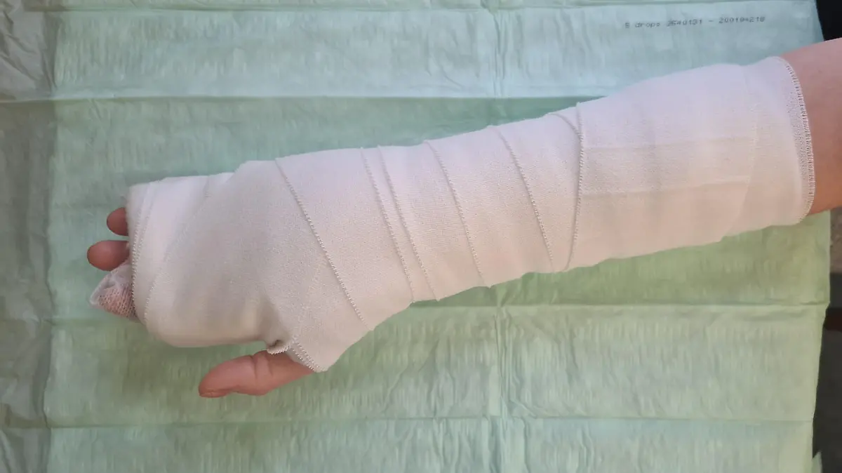 Handverletzung auf OP-Tisch