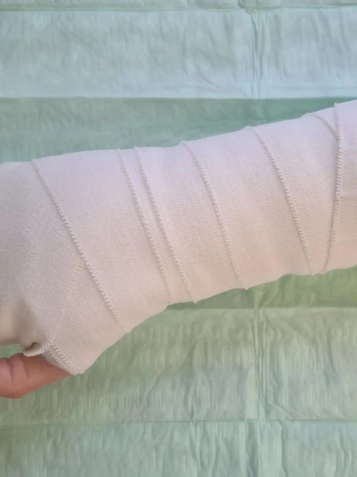 Handverletzung auf OP-Tisch