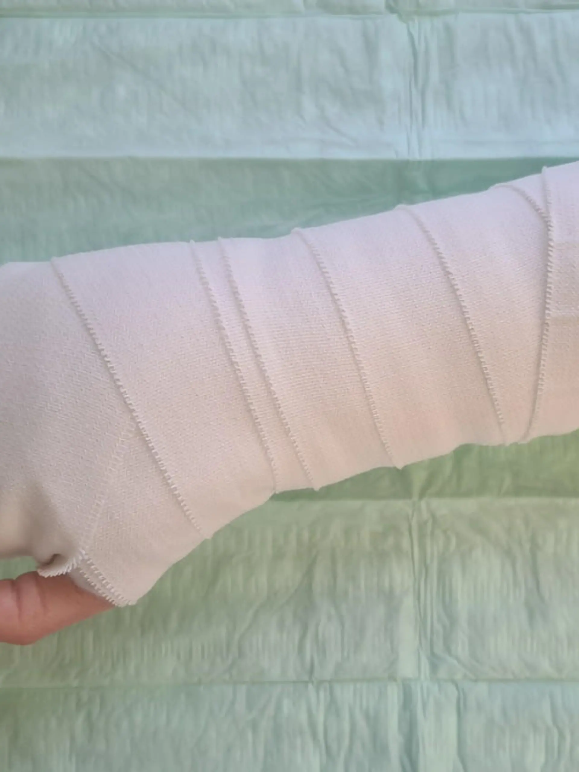 Handverletzung auf OP-Tisch