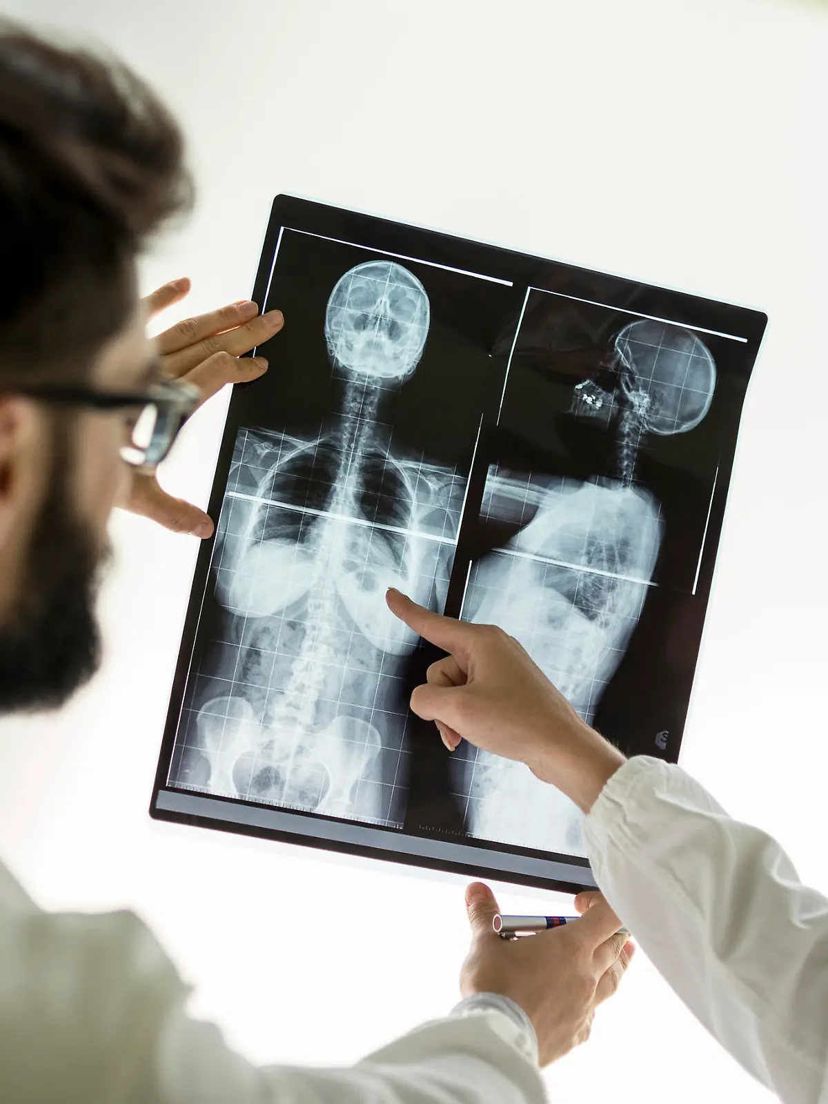 Doctors examining x-ray 